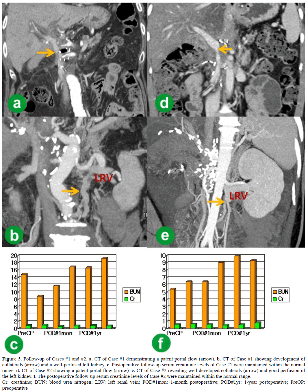 pancreas-follow-up-patent-portal-flow