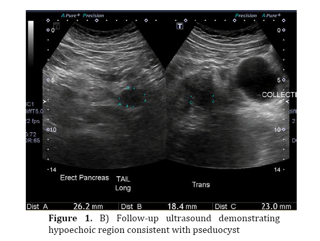 pancreas-follow-up-ultrasound