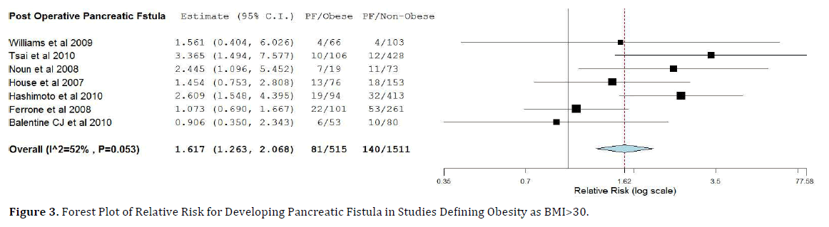 pancreas-forest-pancreatic-fistula