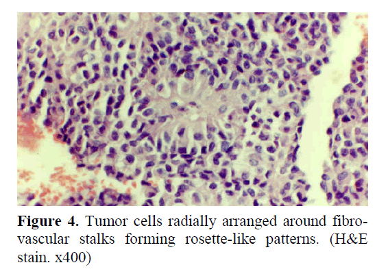 pancreas-forming-rosette-like-patterns