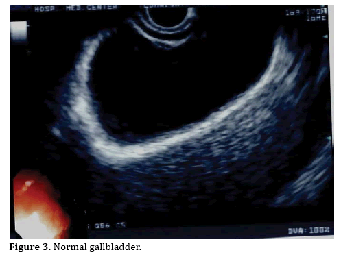 pancreas-gallbladder