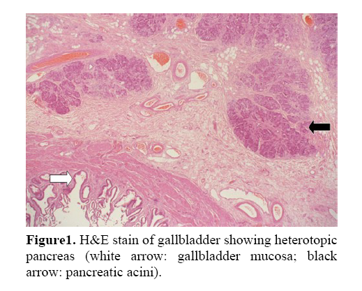 pancreas-gallbladder-mucosa