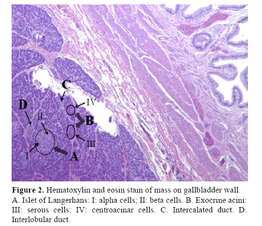 pancreas-gallbladder-wall