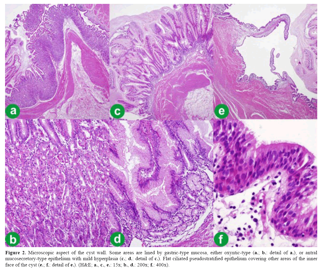 pancreas-gastric-type-mucosa