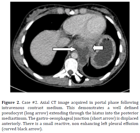 pancreas-gastro-oesophageal-junction