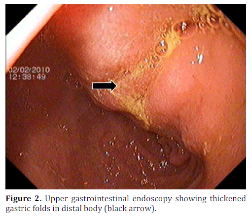 pancreas-gastrointestinal-endoscopy-gastric