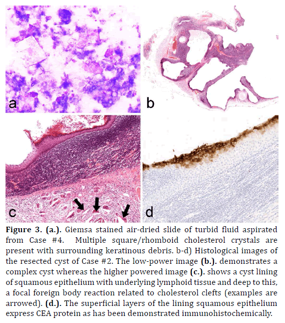 pancreas-giemsa-stained-air-dried-slide