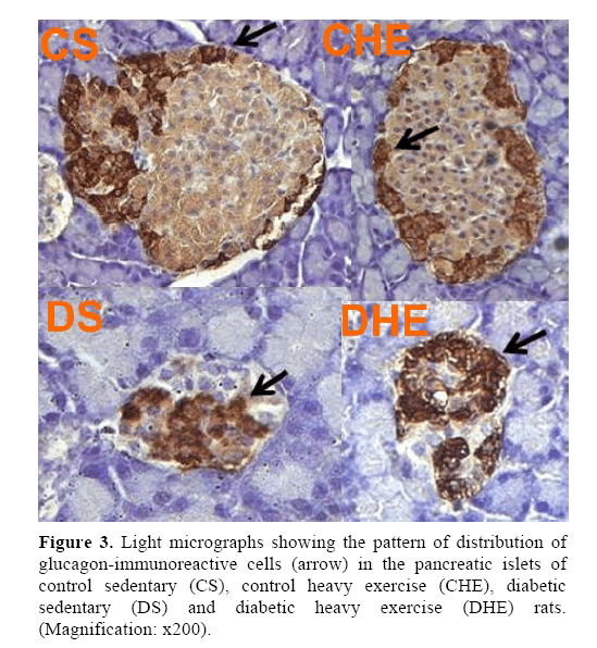 pancreas-glucagon-immunoreactive