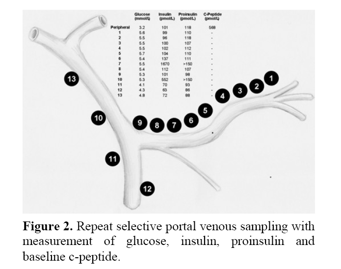 pancreas-glucose-insulin-proinsulin