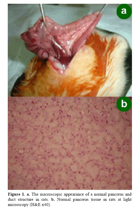 pancreas-glucose-tolerance