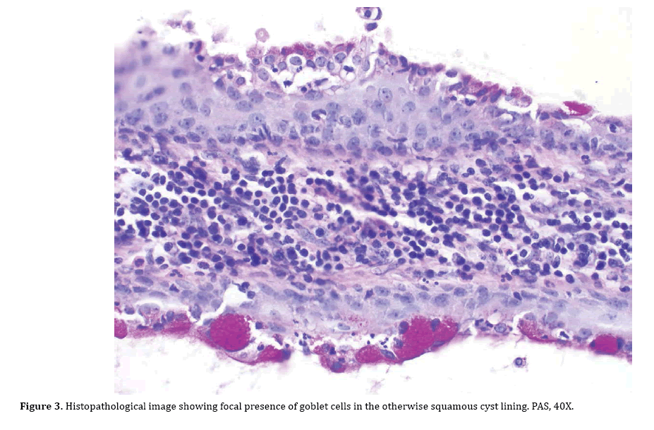 pancreas-goblet