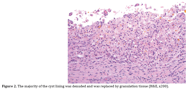 pancreas-granulation