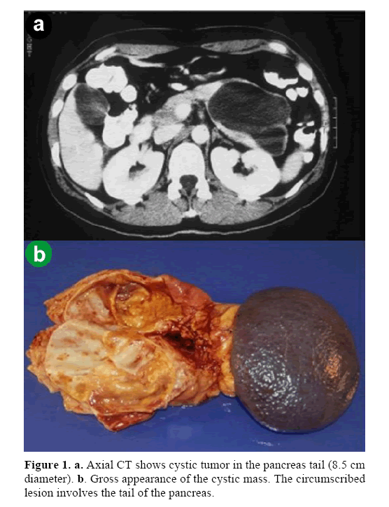 pancreas-gross-appearance