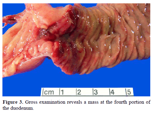 pancreas-gross-examination-reveals