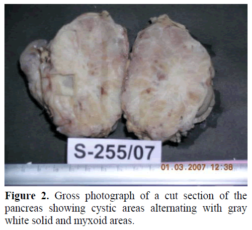 pancreas-gross-photograph-cut-section