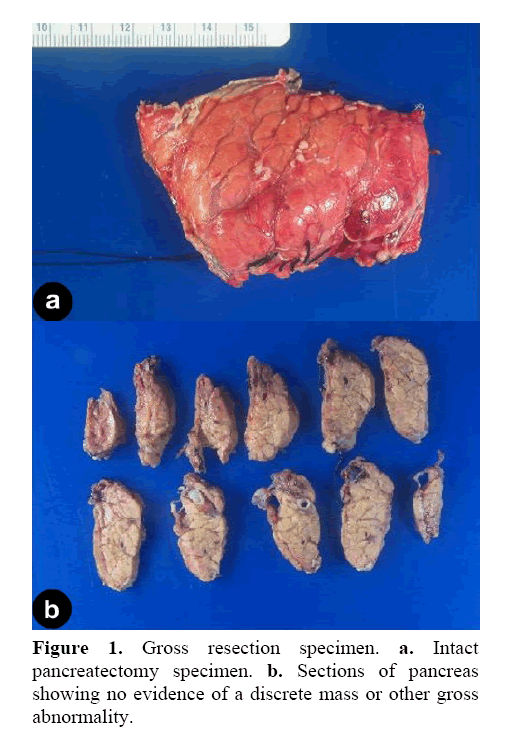 pancreas-gross-resection-specimen