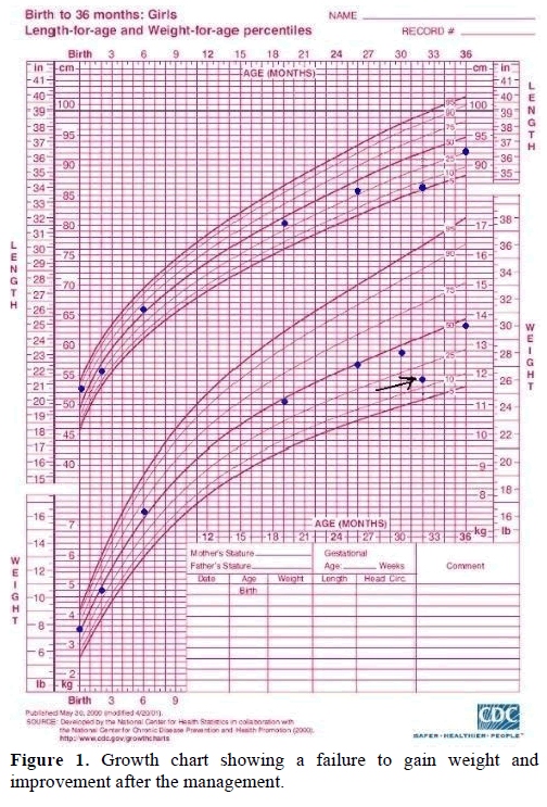 pancreas-growth-chart-failure-gain