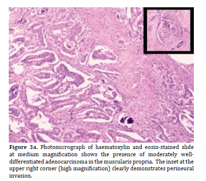 pancreas-haematoxylin