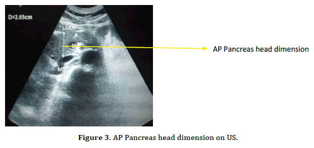 pancreas-head-dimension