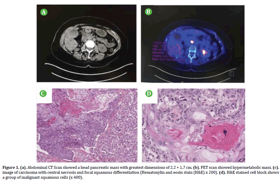 pancreas-head-pancreatic