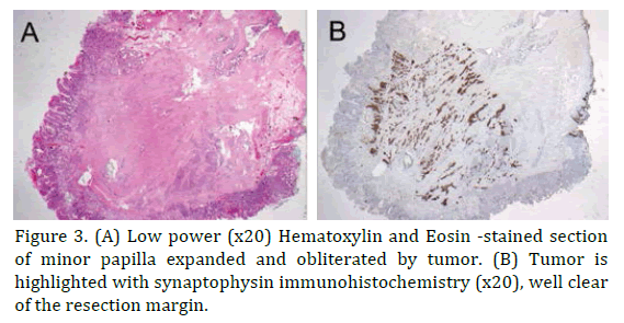 pancreas-hematoxylin-eosin