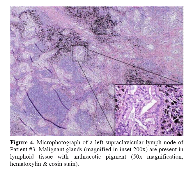 pancreas-hematoxylin-eosin-stain