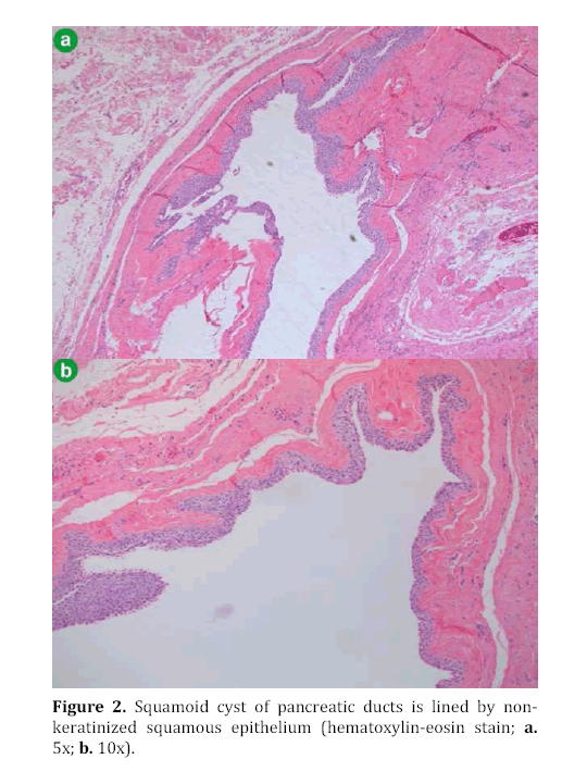 pancreas-hematoxylin-eosin-stain