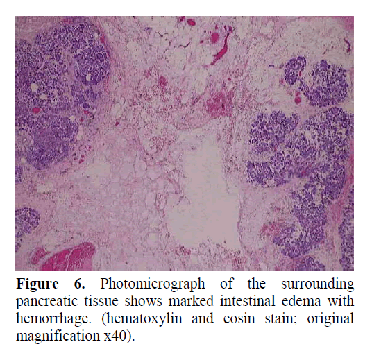pancreas-hematoxylin-eosin-stain