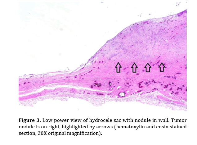 pancreas-hematoxylin-eosin-stained