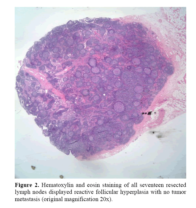 pancreas-hematoxylin-eosin-staining