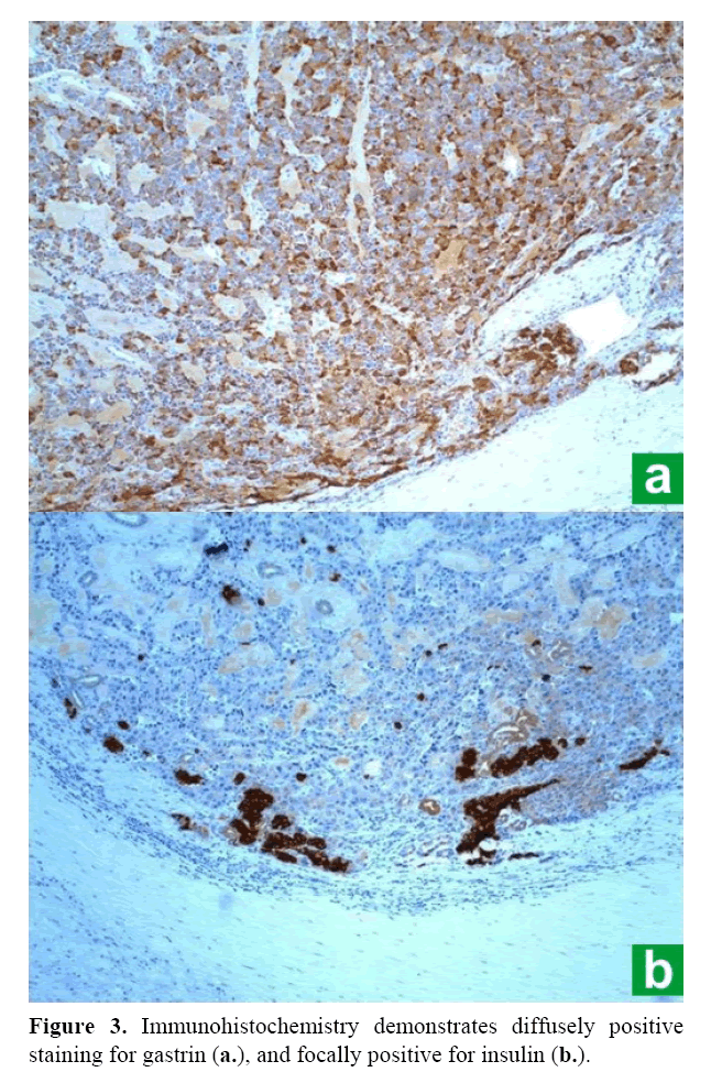 pancreas-hematoxylin-eosin-staining