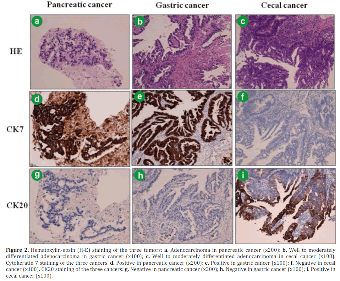 pancreas-hematoxylin-eosin-staining