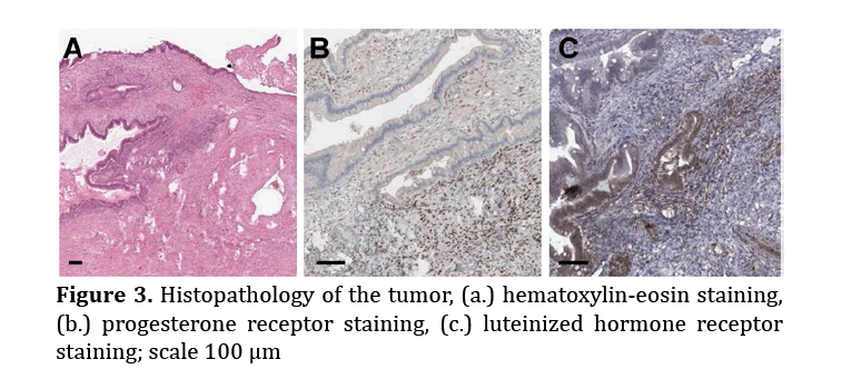 pancreas-hematoxylin-eosin-staining