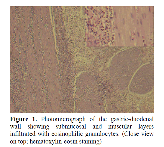 pancreas-hematoxylin-eosin-staining