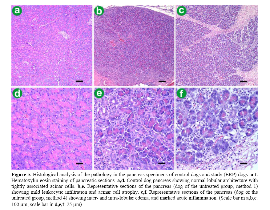 pancreas-hematoxylin-eosin-staining