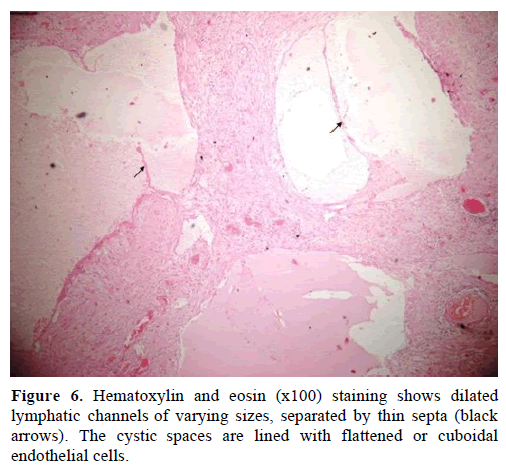pancreas-hematoxylin-lymphatic-varying