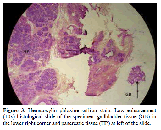 pancreas-hematoxylin-phloxine-saffron-stain