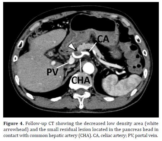 pancreas-hepatic-artery