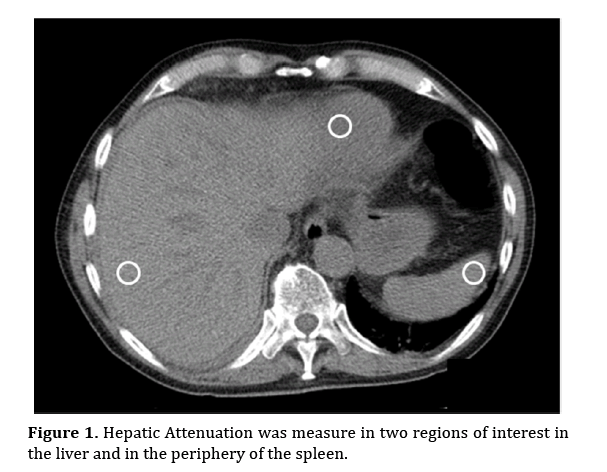 pancreas-hepatic-attenuation