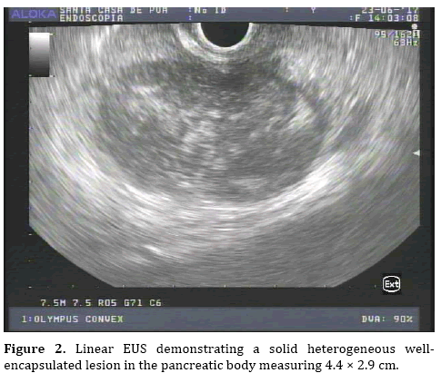 pancreas-heterogeneous