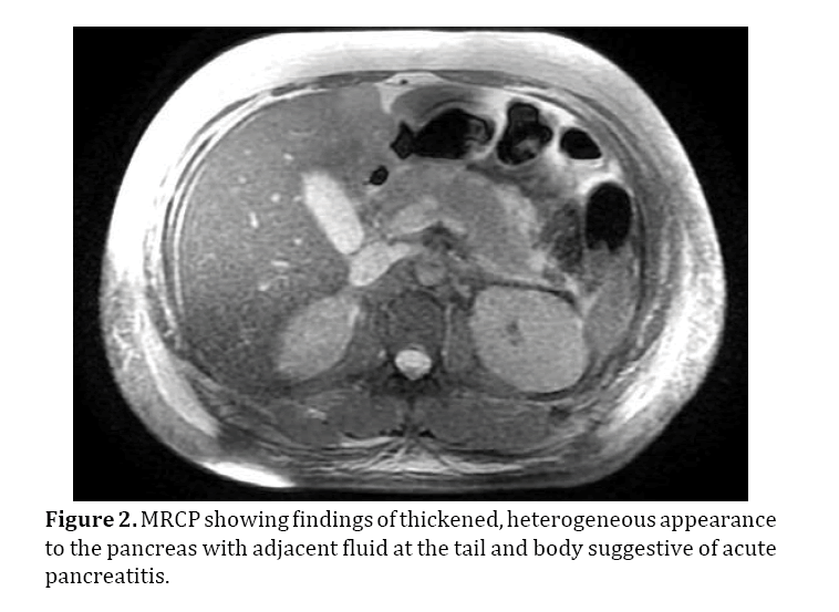 pancreas-heterogeneous-appearance