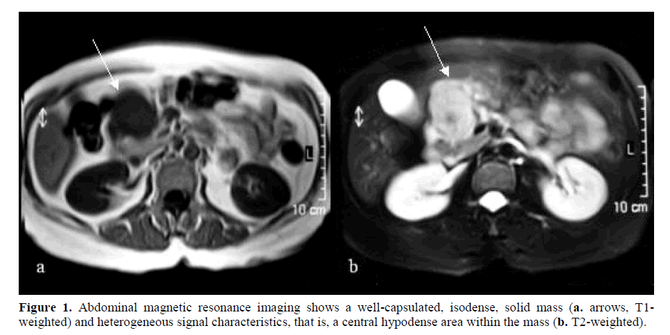 pancreas-heterogeneous-signal