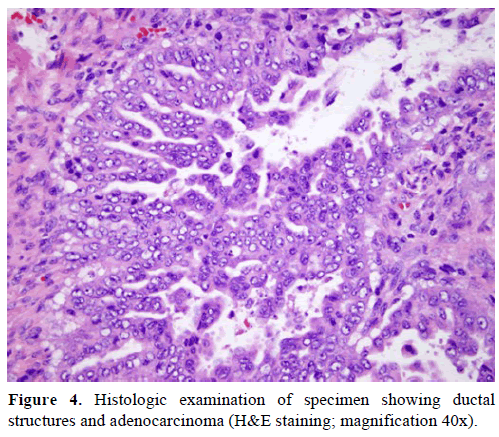 pancreas-histologic-examinatio