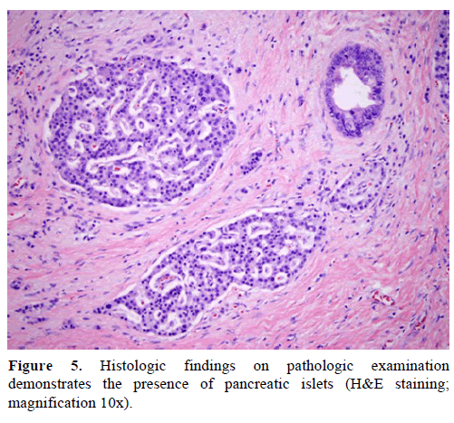 pancreas-histologic-magnification