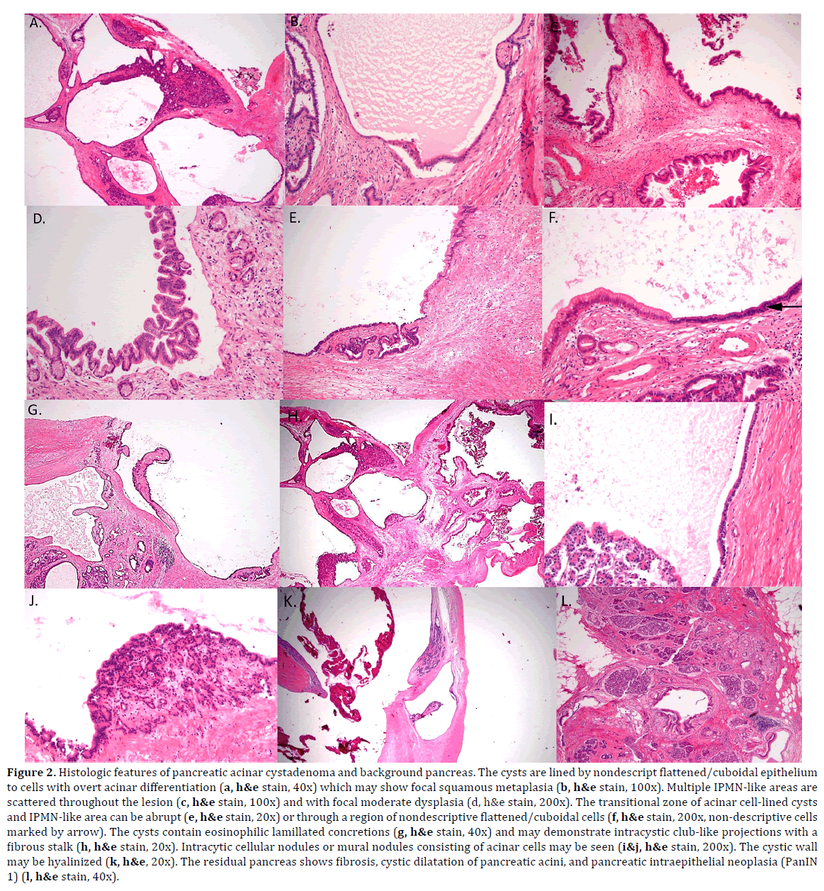 pancreas-histologic-pancreatic-acinar