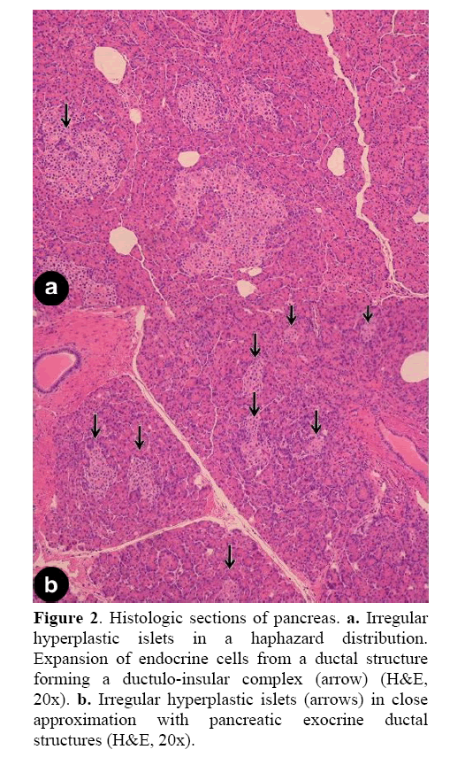 pancreas-histologic-sections-pancreas