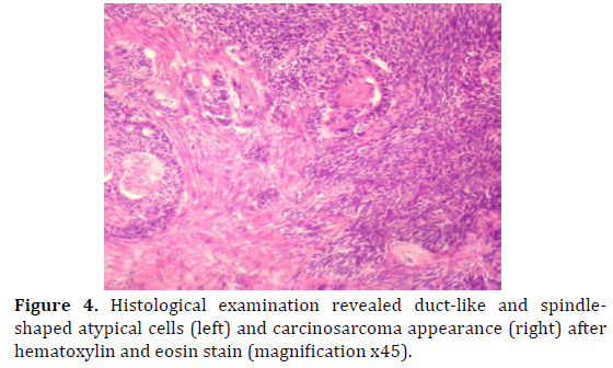 pancreas-histological-examination