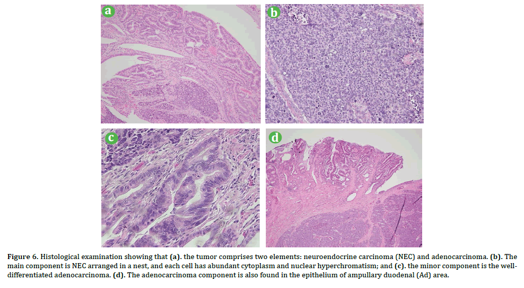 pancreas-histological-examination-comprises