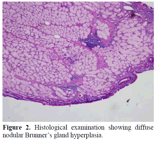 pancreas-histological-examination-diffuse