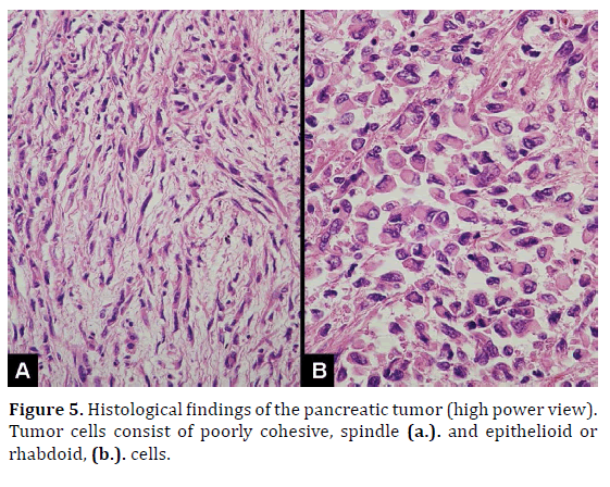 pancreas-histological-findings-high